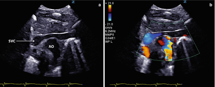 figure 15