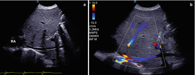 figure 21