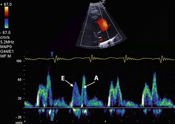 figure 36