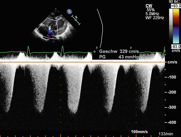 figure 45