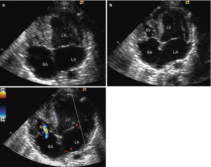 figure 18