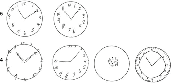 Clock Drawing Test | SpringerLink