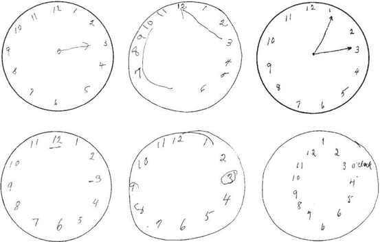 Clock Drawing Test | SpringerLink