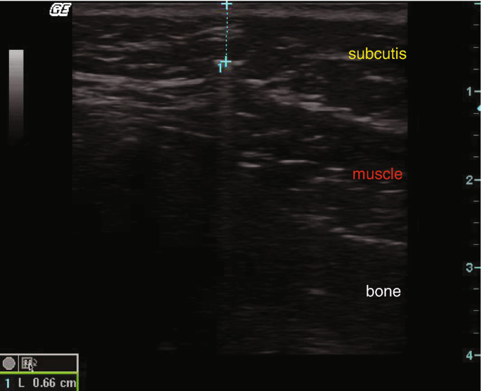 figure 42