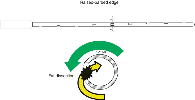 figure 52