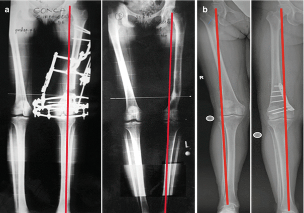 figure 21