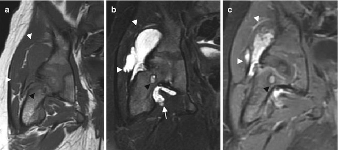 figure 21