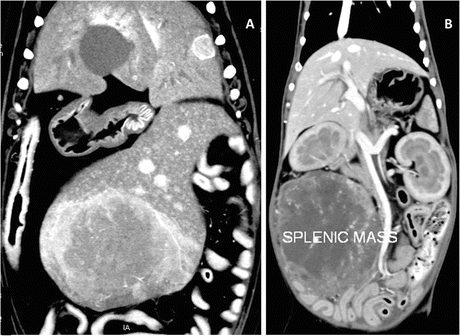 figure 18