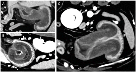 figure 19