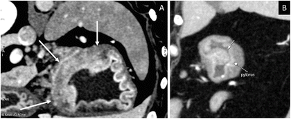 figure 29