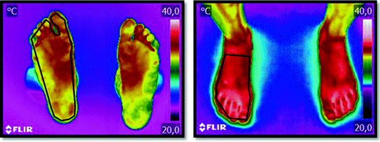 thermal imaging soccer player feet sweat evaporation