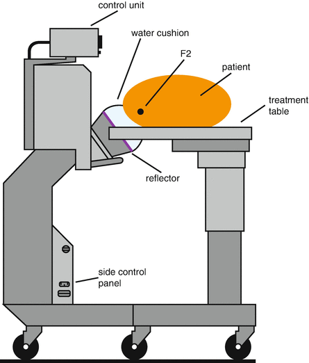 lithotripsy machine diagram