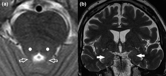 figure 39