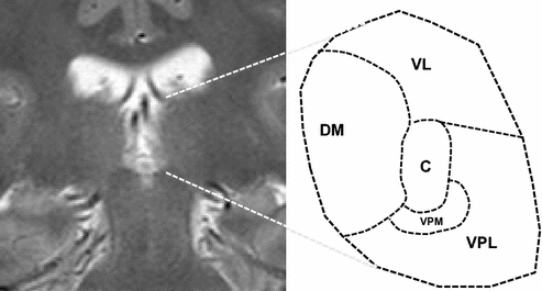 figure 44