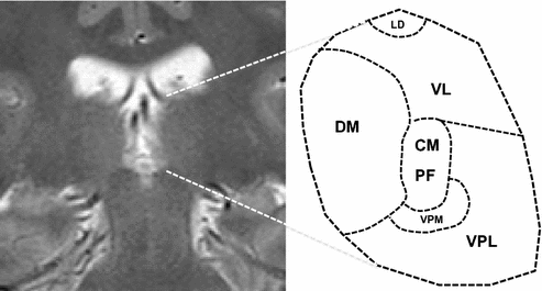 figure 45