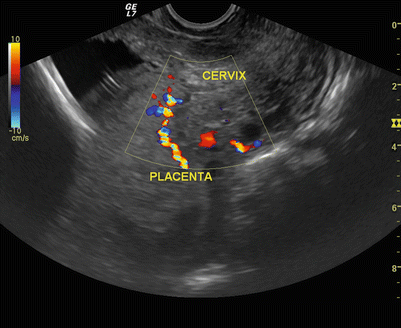 figure 15