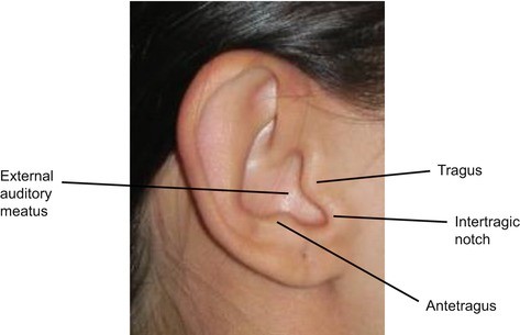 Reconstruction of the External Auditory Canal | SpringerLink