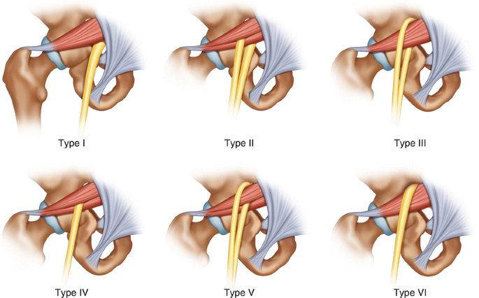 Грушевидная Piriformis