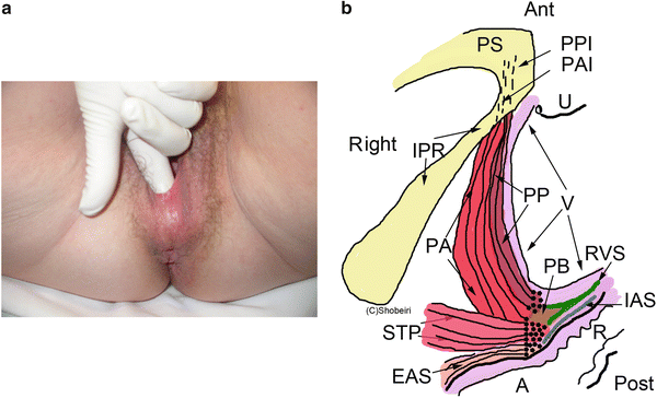 figure 29