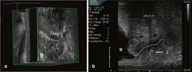 figure 21