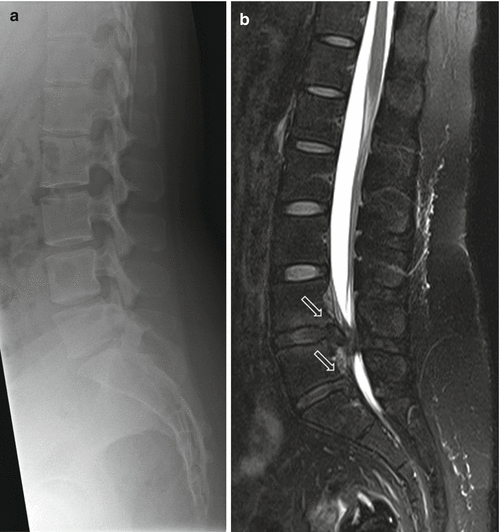 figure 19