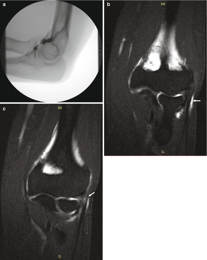 figure 15