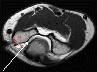 figure 16