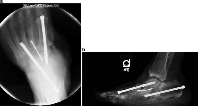 figure 25