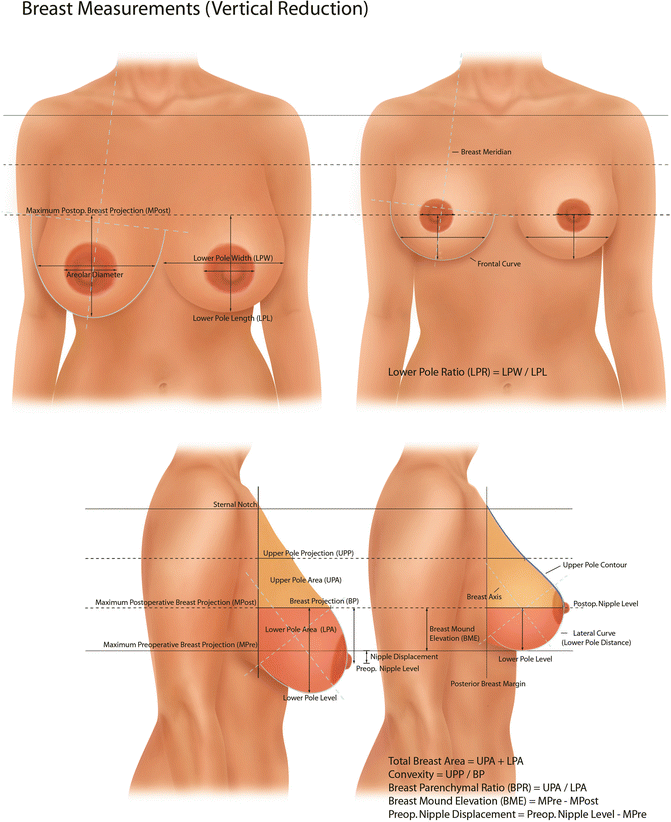 A Measurement System and Ideal Breast Shape