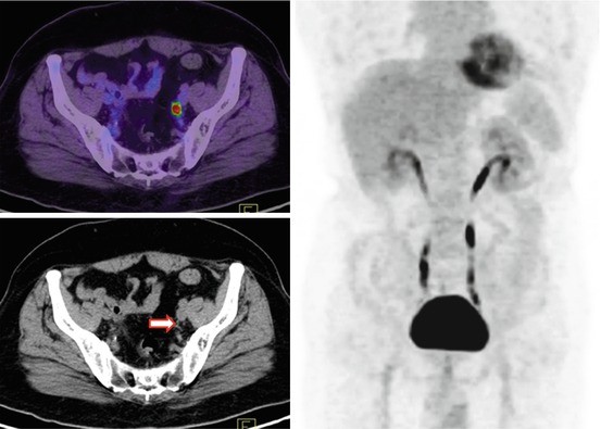 figure 15