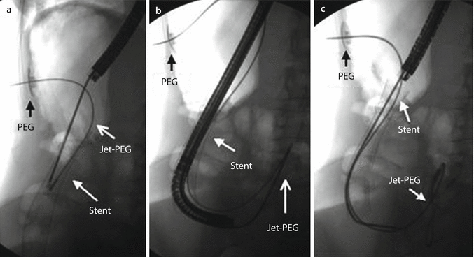 figure 25