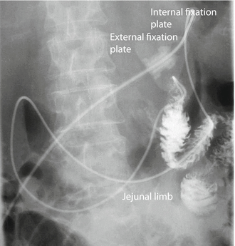 figure 26