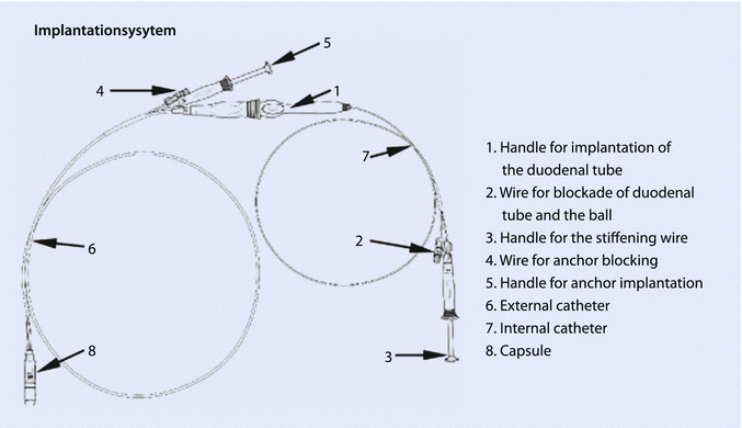 figure 35