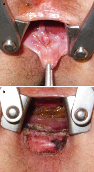 figure 32