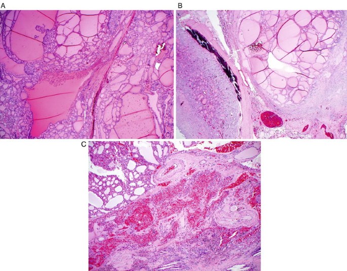 figure 22