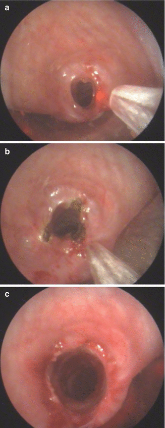 figure 17