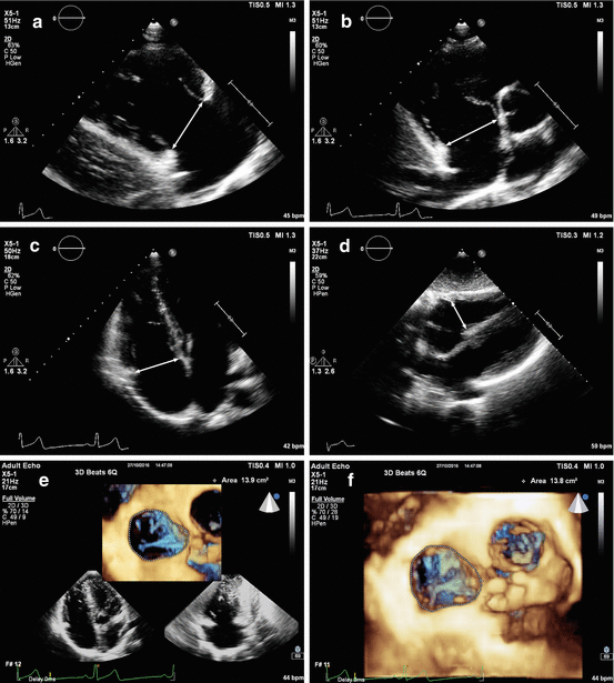 figure 21