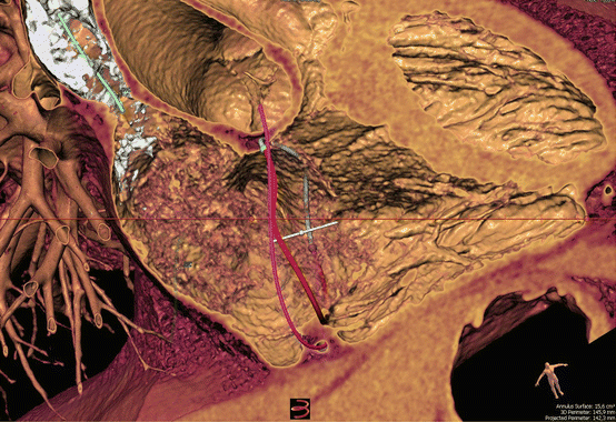 figure 16