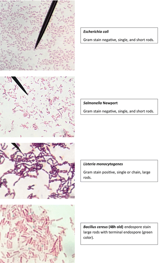 staphylococcus epidermidis endospore stain