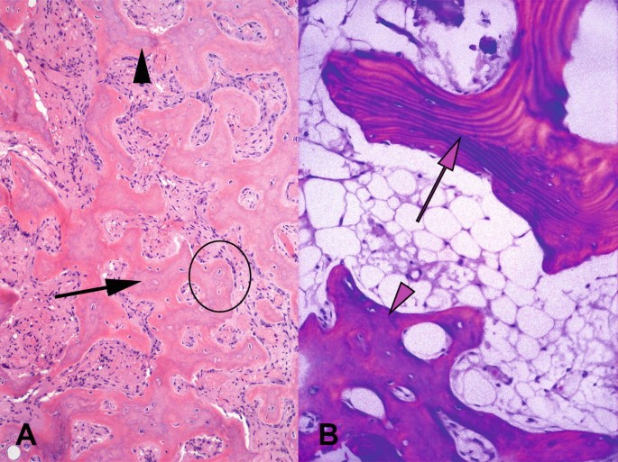 Bone | SpringerLink