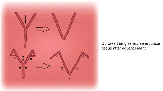 figure 23