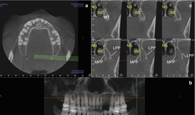 figure 23