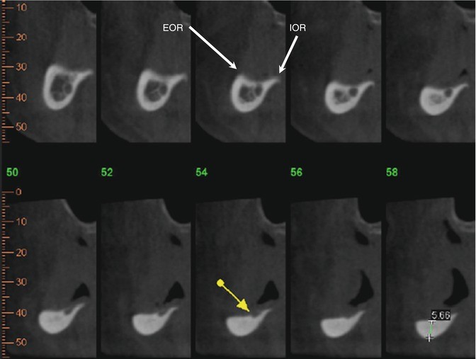 figure 45