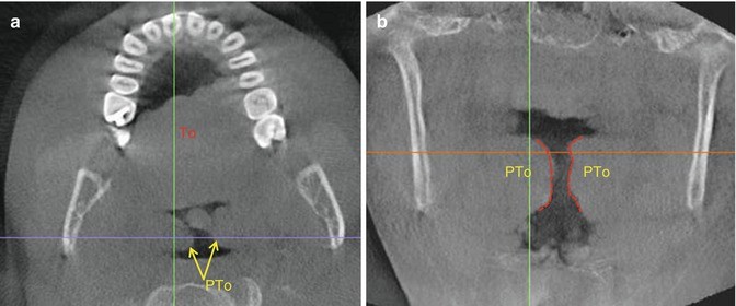 figure 58