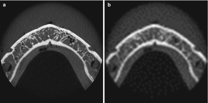 figure 22