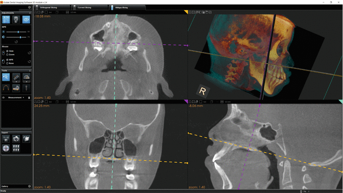 figure 30