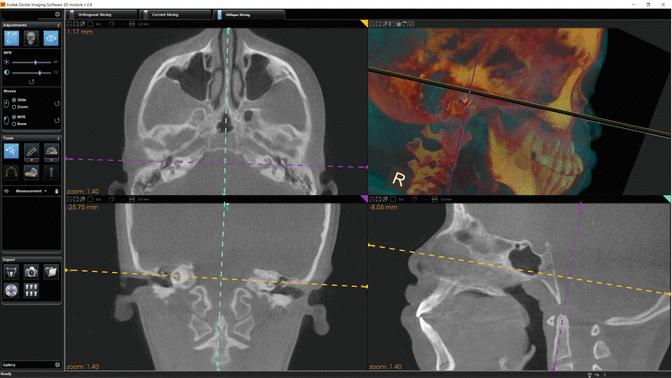 figure 33