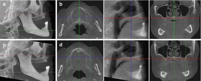 figure 38