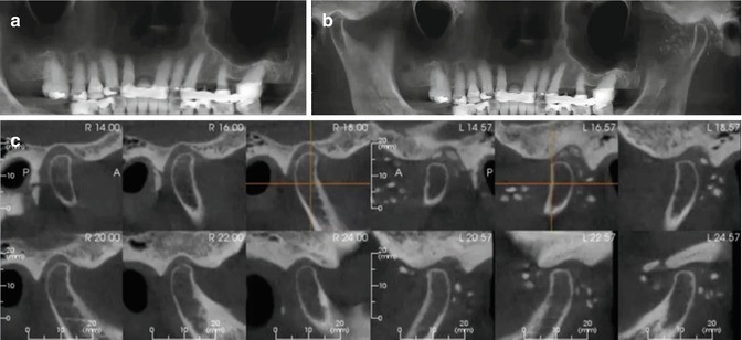 figure 56