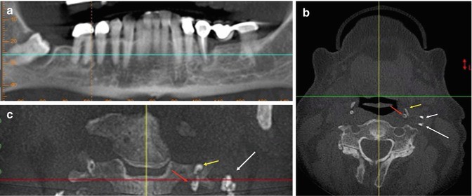 figure 63